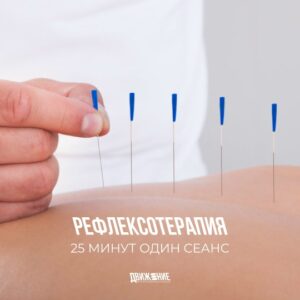 Рефлексотерапия